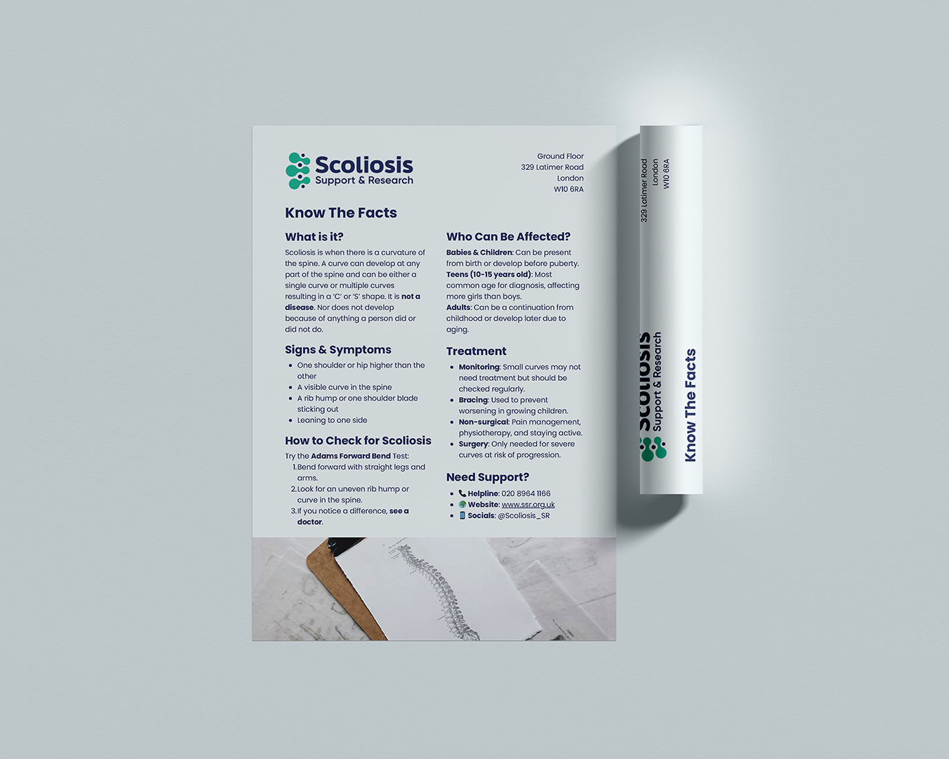 Scoliosis One Sheet