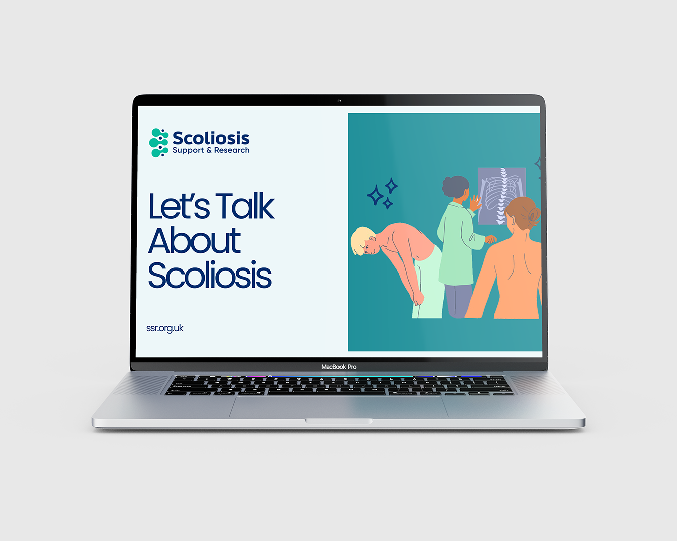 Scoliosis Slides